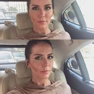 Meet your Posher, Albi